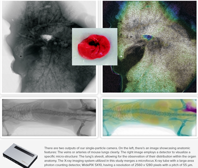 diferenciacion tejidos blando