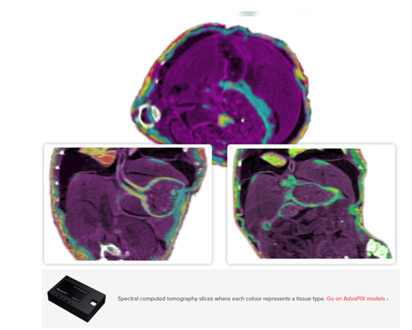 tomografia computerizada espectral